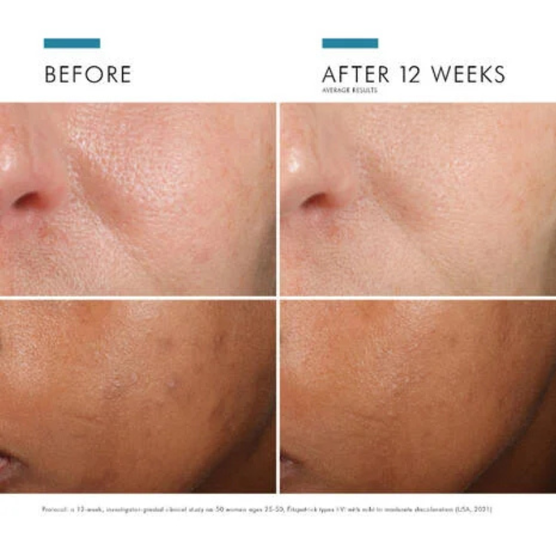 SkinCeuticals Phloretin CF Vitamin C Serum 30ml