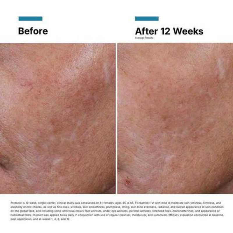 SkinCeuticals Hyaluronic Acid (H.A.) Intensifier Multi-Glycan 30ml