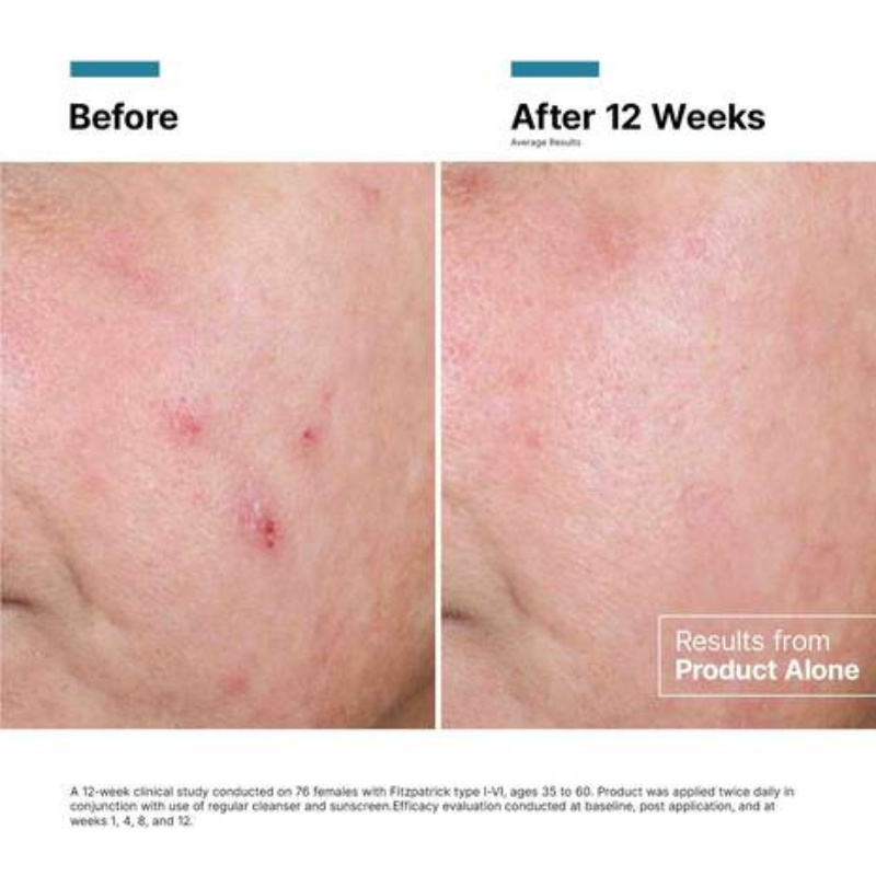 SkinCeuticals Advanced RGN-6 Skin Rejuvenation and Repair Cream 50ml