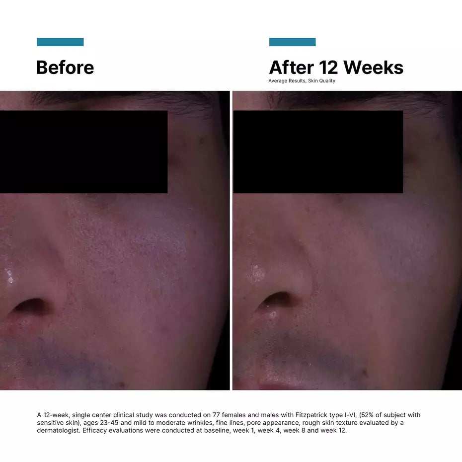 SkinCeuticals P-TIOX Anti-Wrinkle Cream 48ml